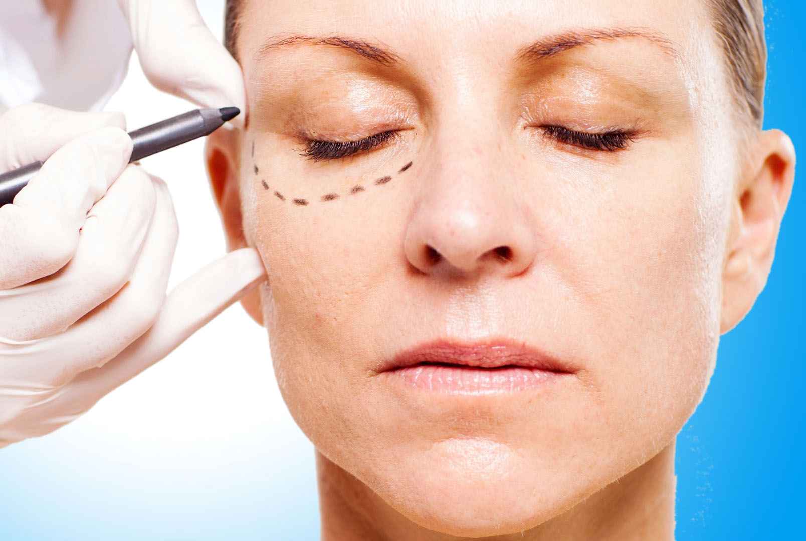 Reportagem sobre Blefaroplastia