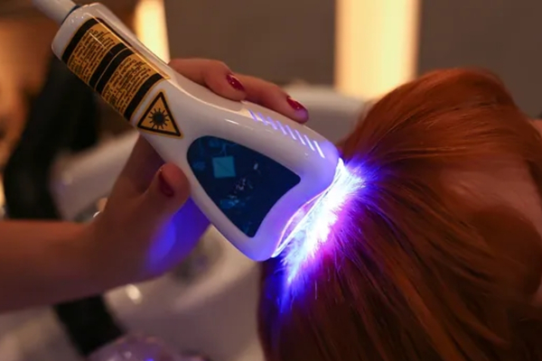 Laser de baixa potência Transplante capilar em sbc