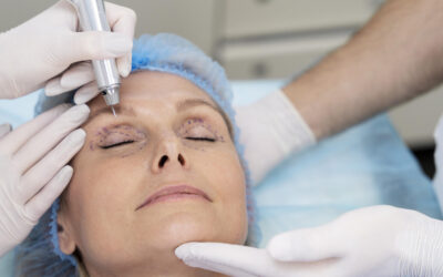 Tratamentos Associados à Blefaroplastia: A Sinergia para um Rejuvenescimento Periocular Completo