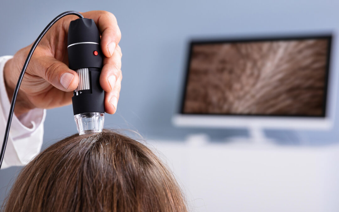 exame para queda de cabelo